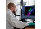 Neurona - Model NRTX-1001 - Inhibitory Neuron Cell Therapy
