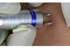 Dimed - Spider Vein Removal Machine