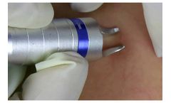 Dimed - Spider Vein Removal Machine