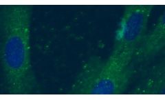 TissueTech - Regenerative Medicine