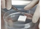 AmnioGraft - Biologic Ocular Transplantation Graft
