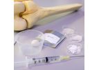 CognitOss Putty - Open Tibial Shaft Fractures