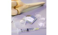 CognitOss Putty - Open Tibial Shaft Fractures