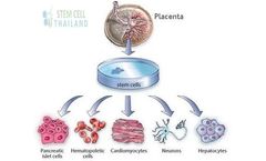 Placenta, Amniotic Membrane & Chorion Derived Stem Cells