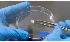 Dental Pulp Derived Stem Cell Extraction,Preservation and Use