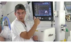Adaptive Support Ventilation (ASV) - How does it work? - Video