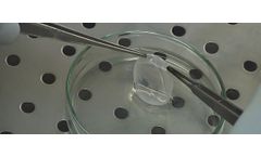 Stem Cell-Based Therapy for Corneal Surface Regeneration
