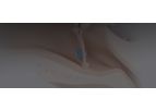 PAVmed DISAPPEAR - Antimicrobial Resorbable Ear Tubes