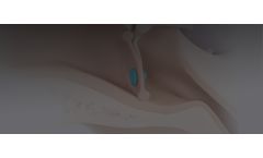 PAVmed DISAPPEAR - Antimicrobial Resorbable Ear Tubes