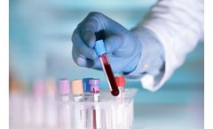 OPKO 4Kscore - Test Kit