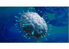Transgene - Model TG4001 - Therapeutic Vaccines