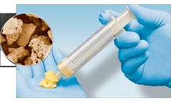 i2b BioV - Bone Putty