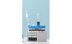 GENETWORx - Total Antibody (IgM & IgG) Assay