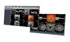 Geidelberg - Version Heyex Pacs - Eye Explorer Software Solution