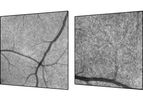 SPECTRALIS - High Magnification Module
