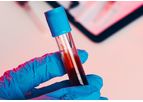 Model FVIII-CAART - Discovery-Stage Candidate for Hemophilia