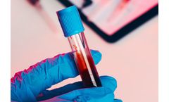 Model FVIII-CAART - Discovery-Stage Candidate for Hemophilia