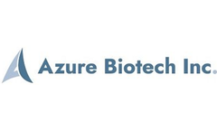 Azure - Human Chorionic Gonadotropin (HCG) Test Kit