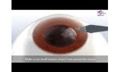 IPCL V2 0 3D Animation - Care Group - Video