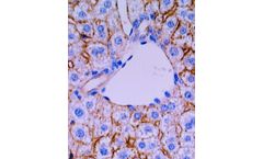 RNA Technology for Medical Areas of Focus Research