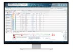 SOPHiA DDM - Cloud-Based Software Platform for Cardiology