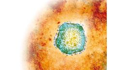 LIAISON - Mumps IgG