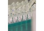 Oncotype - Model DX - Genomic Tests and Services Portfolio