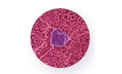 Emulate - Colon Intestine-Chip