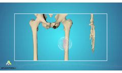 ATLANTHERA - BONE TARGETED DRUG DELIVERY CONCEPT - 12b80 MOLECULE - Video
