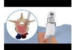 EDGe Surgical, Inc. - Awl-in-one-Tap (AIOT) Animation Spine. Digital Depth Measurement, EMG, Disp - Video