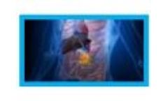 Next Generation of Highly Targeted Antibody Therapeutics - Video