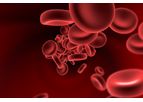 Majelco Medical - Surgical Blood Loss Measurement