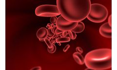 Majelco Medical - Surgical Blood Loss Measurement