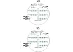 Viramed - Model IgG and IgA - Bordetella Pertussis for the Quantitative Detection