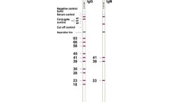Viramed - Borrelia B31 IgG and IgM tests