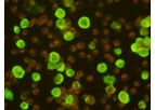 Viramed - Human Herpes Virus 6 IFA IgG, IgM