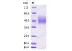 Sino - Model CD89 - 10414-H08H - Human Recombinant Protein (ECD, His Tag)