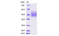 Sino - Model CD89 - 10414-H08H - Human Recombinant Protein (ECD, His Tag)