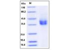 Sino - Model CD89 - 80014-R08H - Rat Recombinant Protein (His Tag)