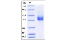Sino - Model CD89 - 80014-R08H - Rat Recombinant Protein (His Tag)