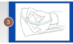 MR Elastography - Patient Setup - Video
