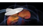 MRE Magnetic Resonance Elastography - Mayo Clinic - Video
