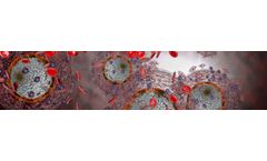 Transforming Patient Care with Immune-based Diagnostics