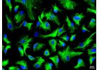 Cytes - Model HuSC - Primary Human Hepatic Stellate Cells