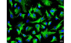 Cytes - Model HuSC - Primary Human Hepatic Stellate Cells