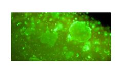 CTIBiotech - 3D Printed Micro-Tumour
