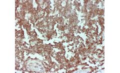 Novodiax - Model CD45 Ab - Antibody for Body Fluid & FNA