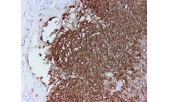 Novodiax - Model CD20 Ab - Rapid IHC Panel
