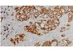 Novodiax - Model AE1/AE3 Abs - Rapid IHC Panel