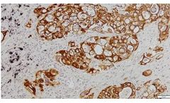 Novodiax - Model AE1/AE3 Abs - Rapid IHC Panel